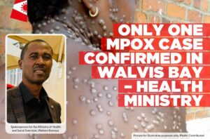 Only-one-Mpox-case-confirmed-in-Walvis-Bay-–-Health-Ministry-Informante-Image-workspace-1024x677.jpg